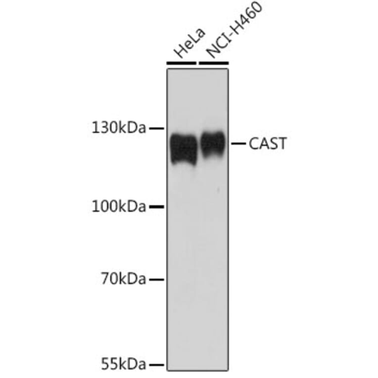 Western Blot - Anti-Calpastatin Antibody (A92564) - Antibodies.com