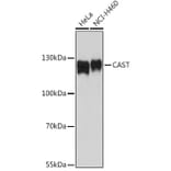 Western Blot - Anti-Calpastatin Antibody (A92564) - Antibodies.com
