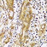 Immunohistochemistry - Anti-Calpastatin Antibody (A92564) - Antibodies.com