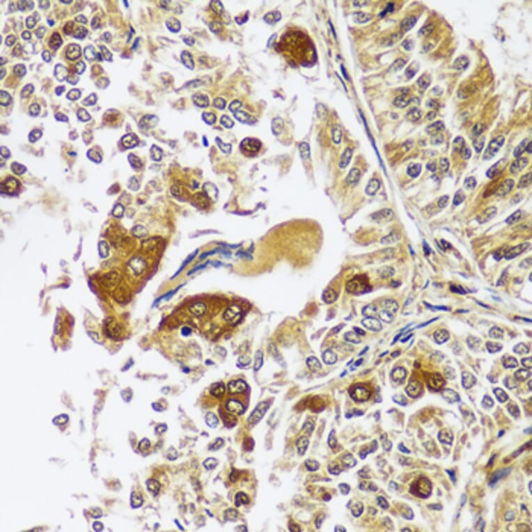 Immunohistochemistry - Anti-Calpastatin Antibody (A92564) - Antibodies.com