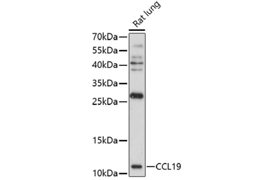 Western Blot - Anti-MIP-3 beta/CCL19 Antibody (A92565) - Antibodies.com