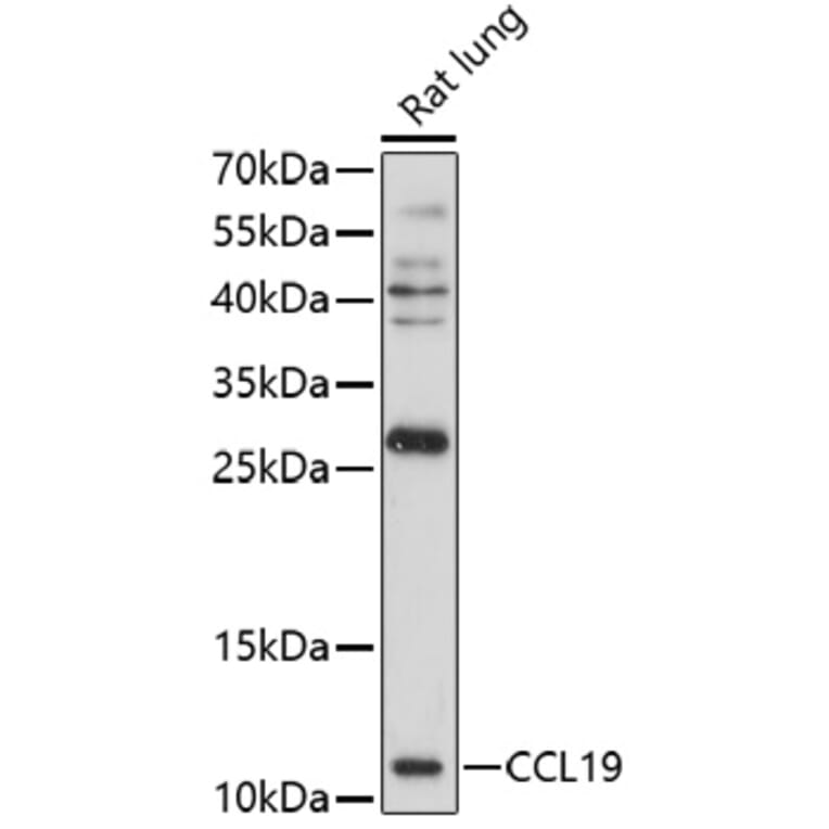 Western Blot - Anti-MIP-3 beta/CCL19 Antibody (A92565) - Antibodies.com