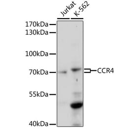 Western Blot - Anti-CCR4 Antibody (A92566) - Antibodies.com