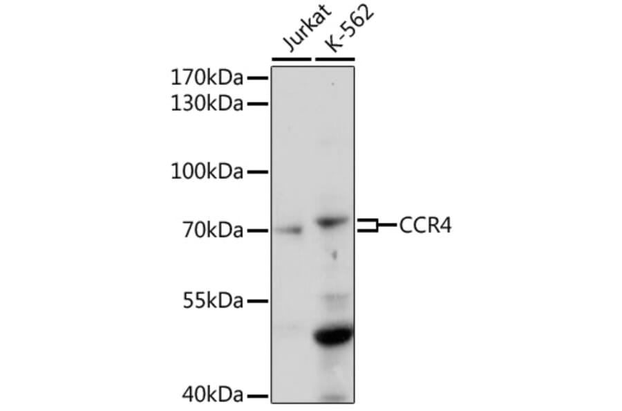 Western Blot - Anti-CCR4 Antibody (A92566) - Antibodies.com