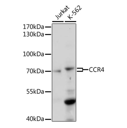 Western Blot - Anti-CCR4 Antibody (A92566) - Antibodies.com