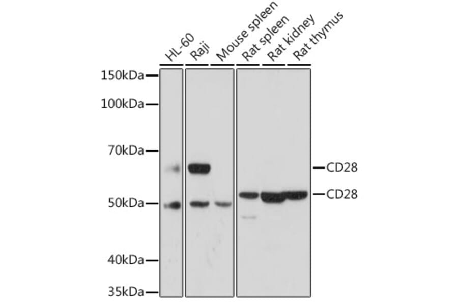 Western Blot - Anti-CD28 Antibody (A92567) - Antibodies.com