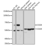 Western Blot - Anti-CD28 Antibody (A92567) - Antibodies.com
