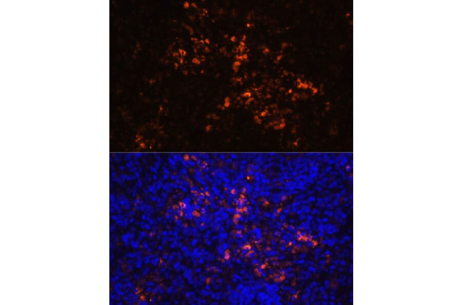 Immunofluorescence - Anti-CD70 Antibody (A92568) - Antibodies.com