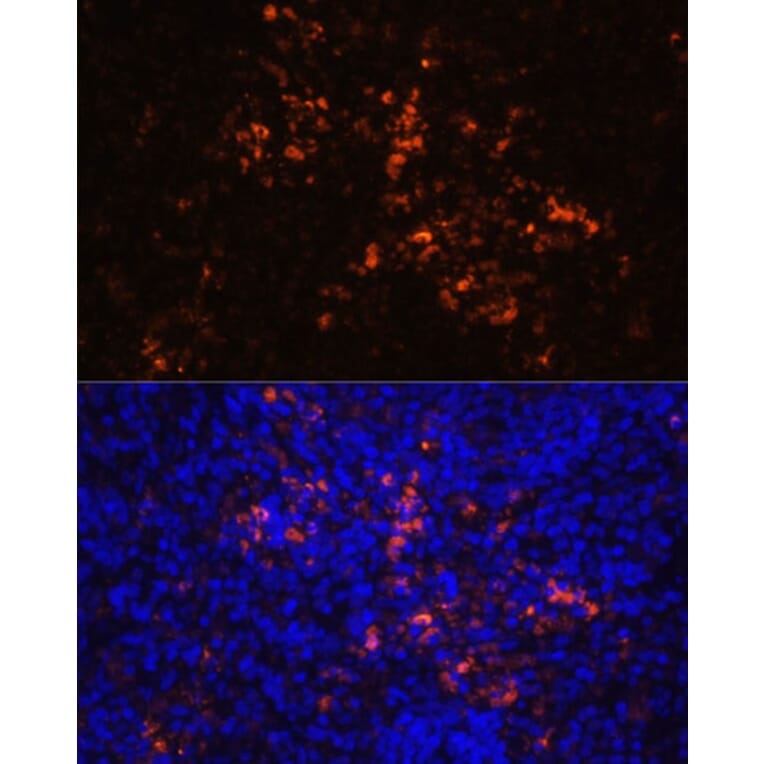 Immunofluorescence - Anti-CD70 Antibody (A92568) - Antibodies.com
