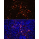 Immunofluorescence - Anti-CD70 Antibody (A92568) - Antibodies.com