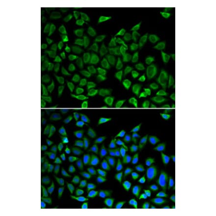 Immunofluorescence - Anti-CDC45L Antibody (A92569) - Antibodies.com