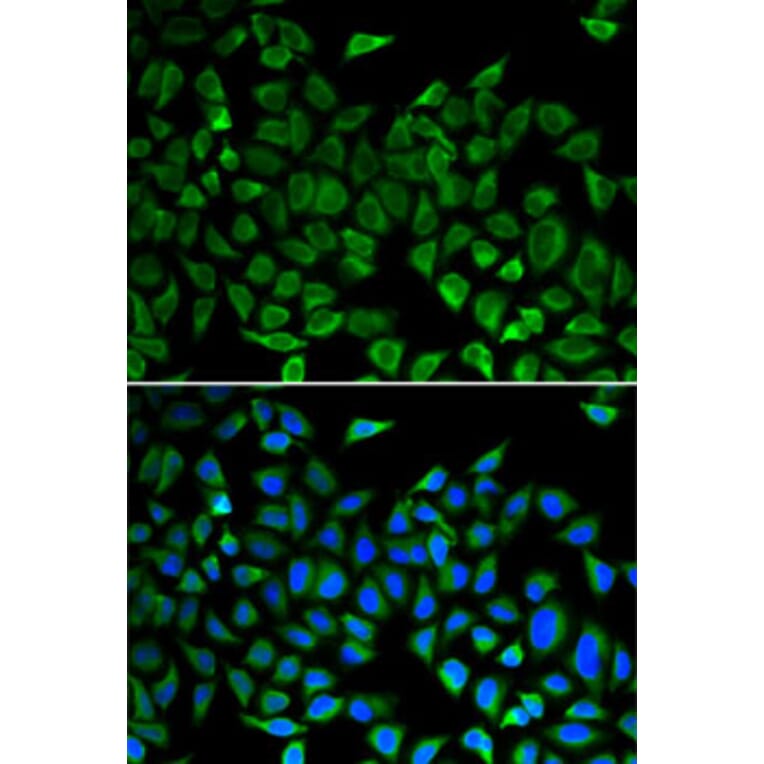 Immunofluorescence - Anti-CDC45L Antibody (A92569) - Antibodies.com