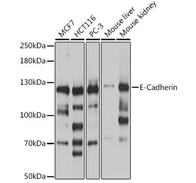 Western Blot - Anti-E Cadherin Antibody (A92570) - Antibodies.com