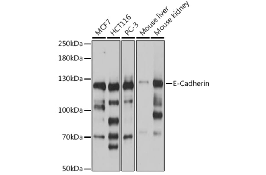 Western Blot - Anti-E Cadherin Antibody (A92570) - Antibodies.com