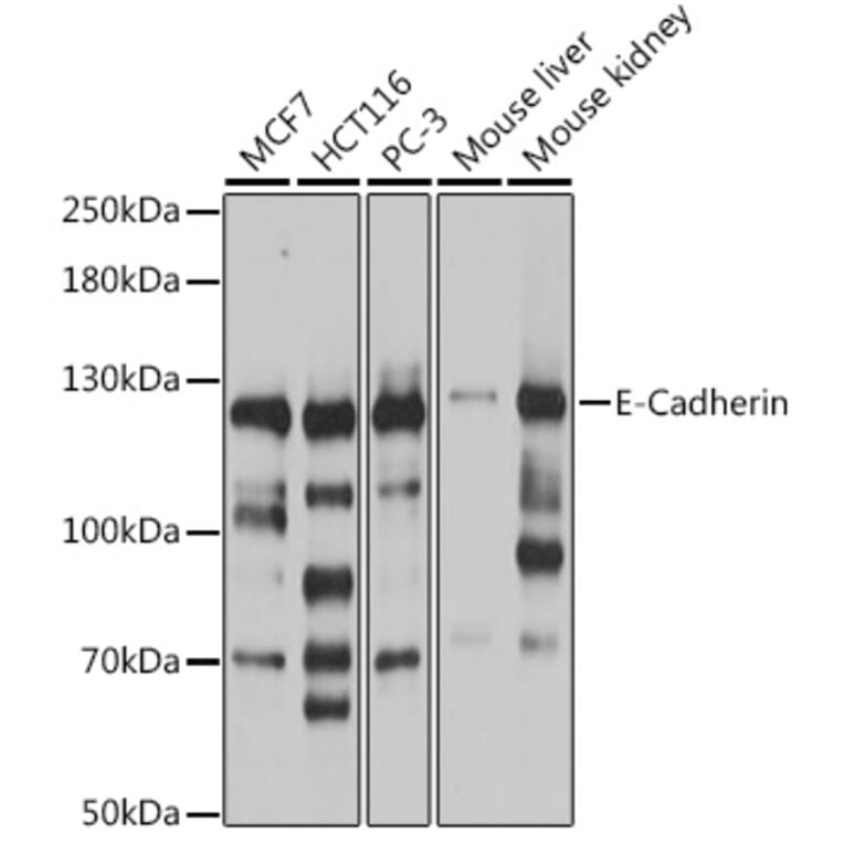 Western Blot - Anti-E Cadherin Antibody (A92570) - Antibodies.com