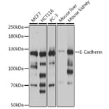 Western Blot - Anti-E Cadherin Antibody (A92570) - Antibodies.com