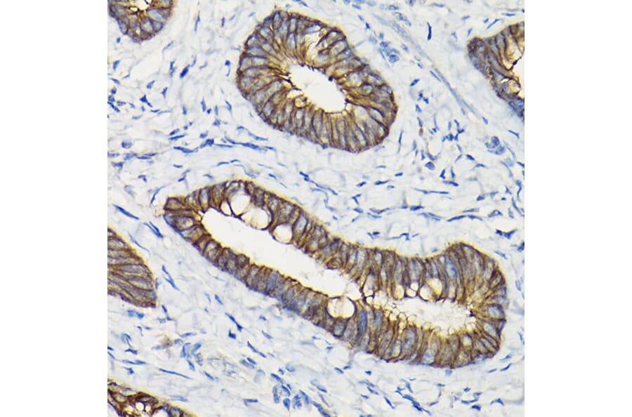 Immunohistochemistry - Anti-E Cadherin Antibody (A92570) - Antibodies.com