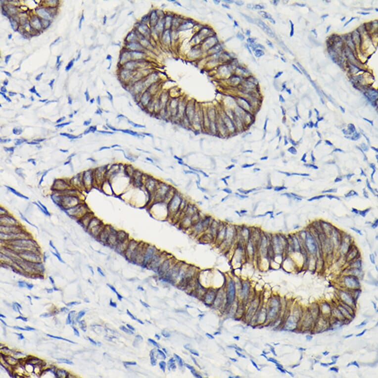 Immunohistochemistry - Anti-E Cadherin Antibody (A92570) - Antibodies.com