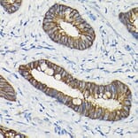 Immunohistochemistry - Anti-E Cadherin Antibody (A92570) - Antibodies.com