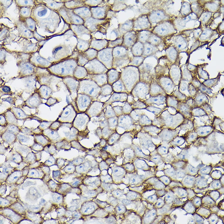 Immunohistochemistry - Anti-E Cadherin Antibody (A92570) - Antibodies.com