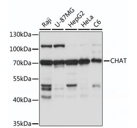 Western Blot - Anti-Choline Acetyltransferase Antibody (A92571) - Antibodies.com