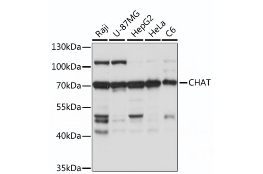 Western Blot - Anti-Choline Acetyltransferase Antibody (A92571) - Antibodies.com