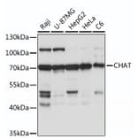 Western Blot - Anti-Choline Acetyltransferase Antibody (A92571) - Antibodies.com
