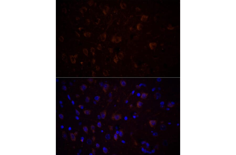 Immunofluorescence - Anti-Choline Acetyltransferase Antibody (A92571) - Antibodies.com