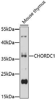 Western blot analysis of extracts of mouse thymus, using Anti-CHORDC1 Antibody (A17135) at 1:1,000 dilution.
Secondary antibody: Goat Anti-Rabbit IgG (H+L) (HRP) (AS014) at 1:10,000 dilution.
Lysates / proteins: 25µg per lane.
Blocking buffer: 3% non-fat dry milk in TBST.
Detection: ECL Basic Kit (RM00020).
Exposure time: 60s.