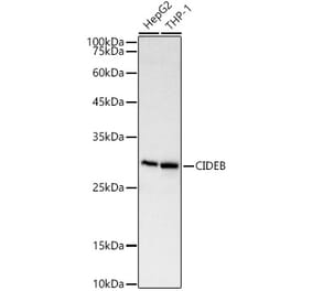 Western Blot - Anti-CIDE B Antibody (A92575) - Antibodies.com