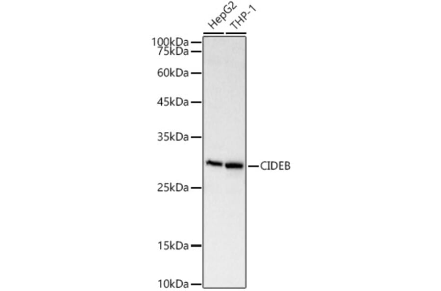Western Blot - Anti-CIDE B Antibody (A92575) - Antibodies.com