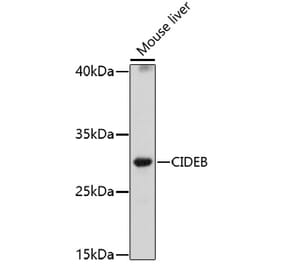 Western Blot - Anti-CIDE B Antibody (A92576) - Antibodies.com