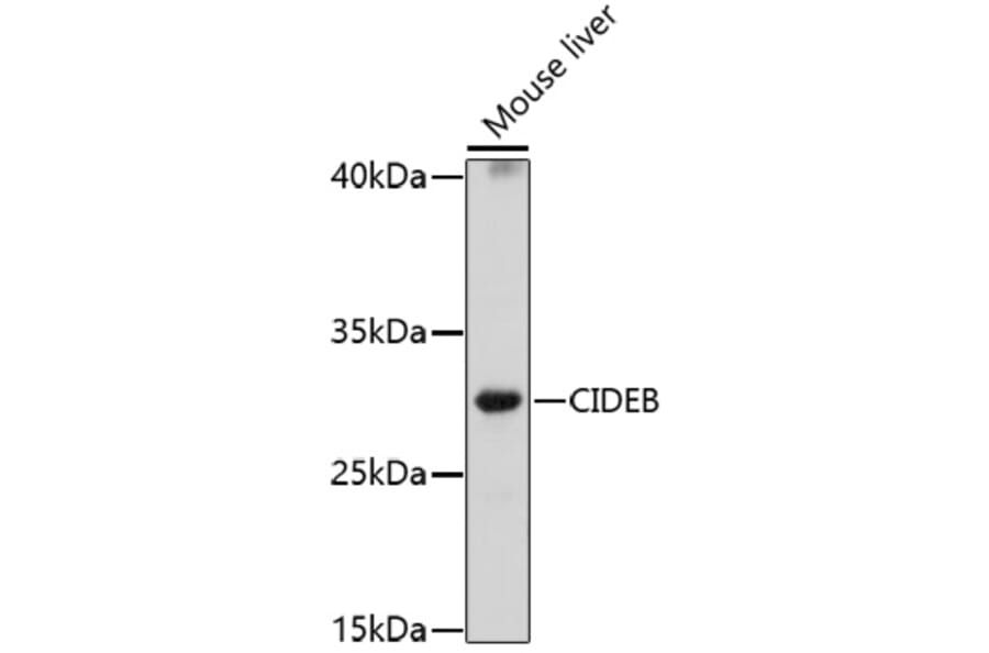 Western Blot - Anti-CIDE B Antibody (A92576) - Antibodies.com