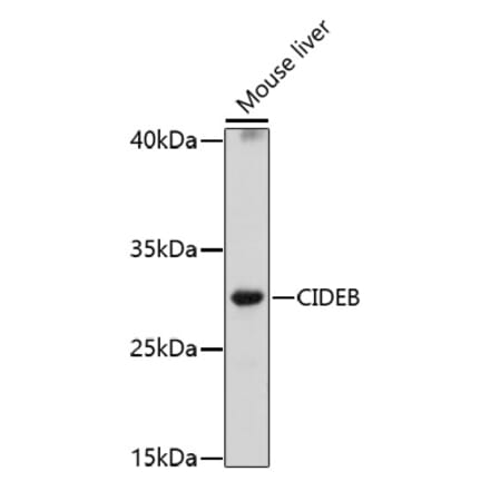 Western Blot - Anti-CIDE B Antibody (A92576) - Antibodies.com