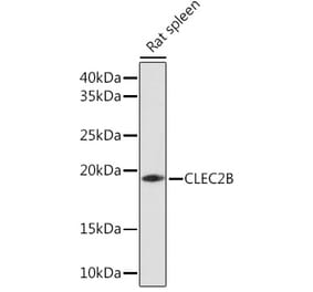 Western Blot - Anti-AICL Antibody (A92577) - Antibodies.com