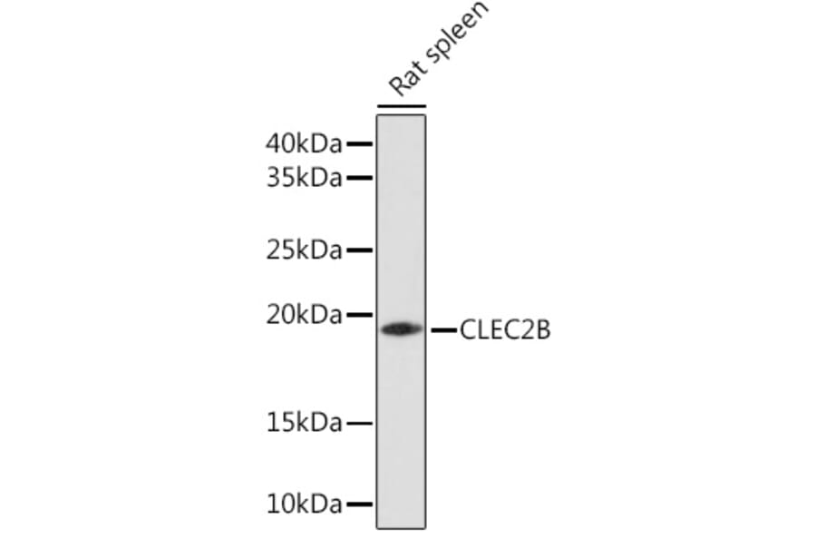 Western Blot - Anti-AICL Antibody (A92577) - Antibodies.com