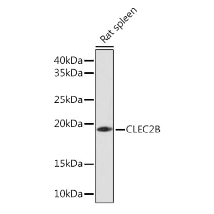 Western Blot - Anti-AICL Antibody (A92577) - Antibodies.com