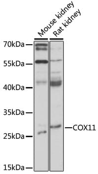Western blot analysis of extracts of various cell lines, using Anti-COX11 Antibody (A16290) at 1:1,000 dilution.
Secondary antibody: Goat Anti-Rabbit IgG (H+L) (HRP) (AS014) at 1:10,000 dilution.
Lysates / proteins: 25µg per lane.
Blocking buffer: 3% non-fat dry milk in TBST.
Detection: ECL Basic Kit (RM00020).
Exposure time: 30s.