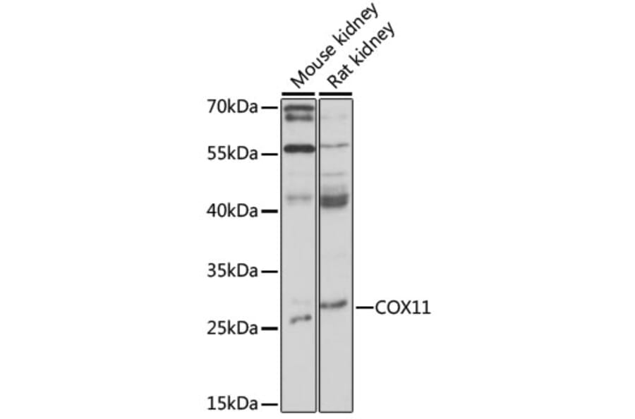 Western Blot - Anti-COX11 Antibody (A92578) - Antibodies.com