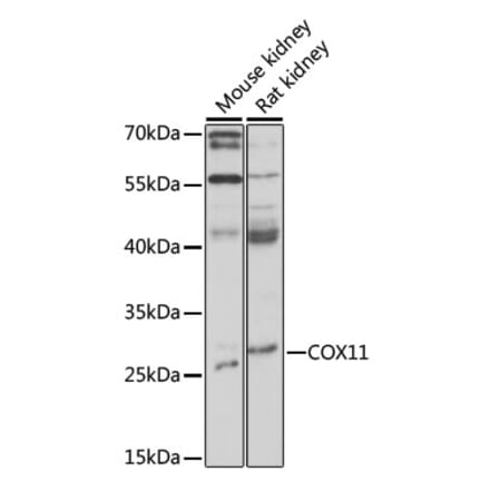 Western Blot - Anti-COX11 Antibody (A92578) - Antibodies.com
