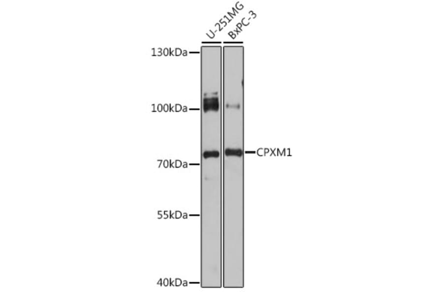 Western Blot - Anti-CPXM1 Antibody (A92579) - Antibodies.com