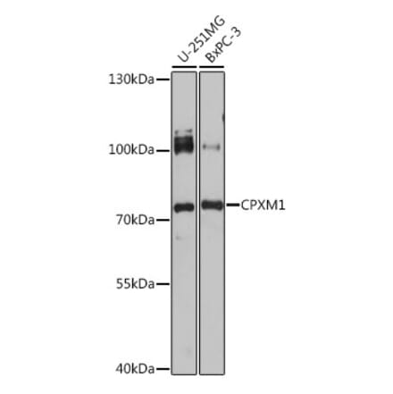 Western Blot - Anti-CPXM1 Antibody (A92579) - Antibodies.com