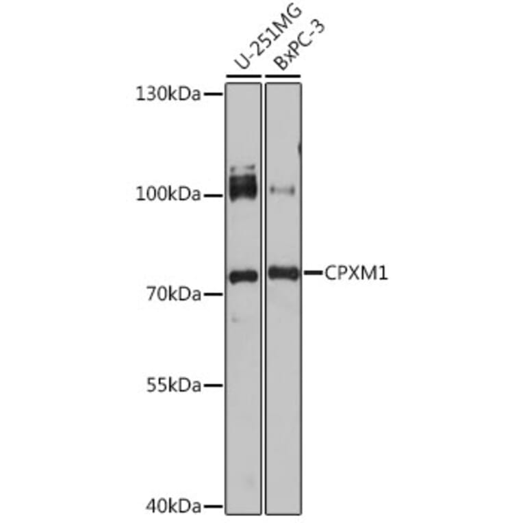 Western Blot - Anti-CPXM1 Antibody (A92579) - Antibodies.com