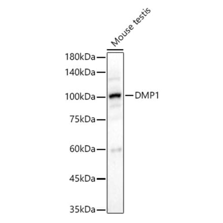 Western Blot - Anti-DMP1 Antibody (A92583) - Antibodies.com