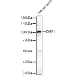 Western Blot - Anti-DMP1 Antibody (A92583) - Antibodies.com
