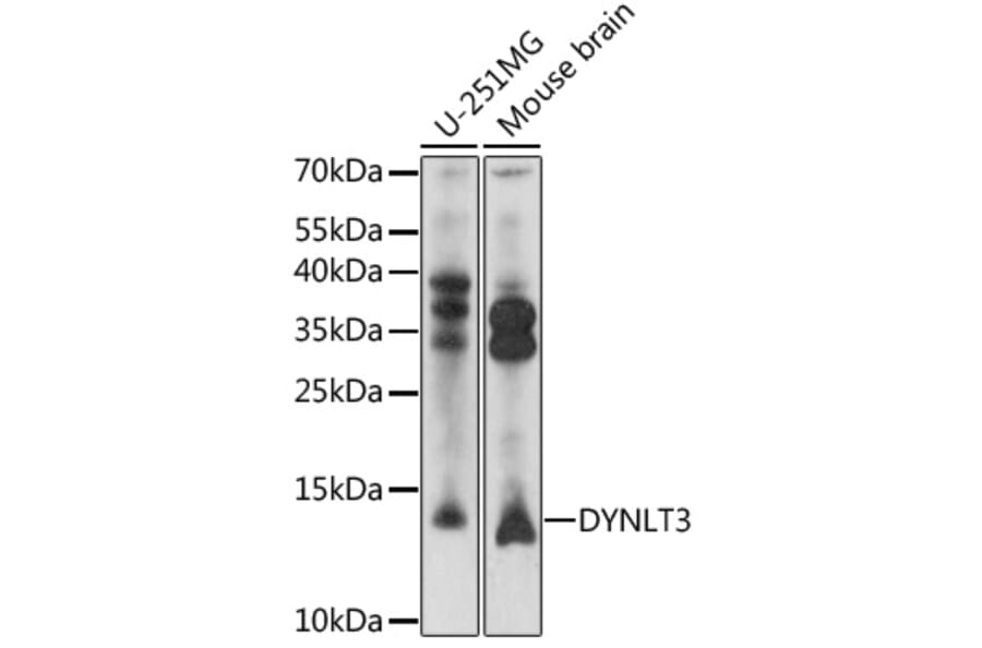 Western Blot - Anti-DYNLT3 Antibody (A92586) - Antibodies.com