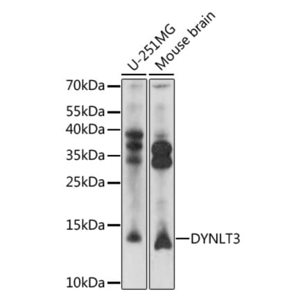 Western Blot - Anti-DYNLT3 Antibody (A92586) - Antibodies.com