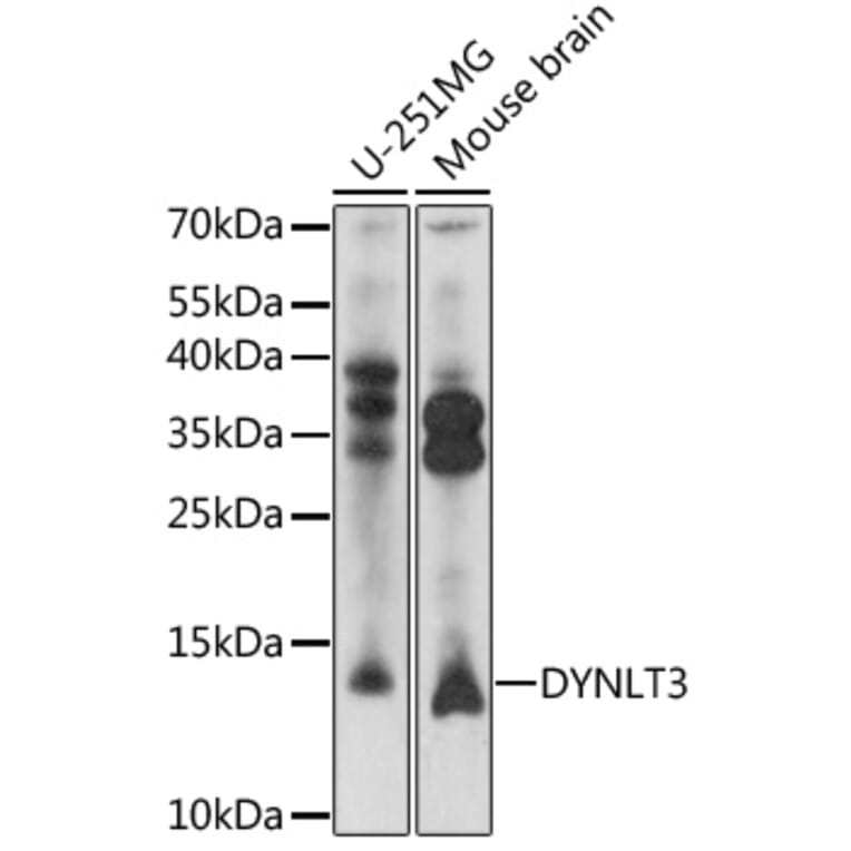 Western Blot - Anti-DYNLT3 Antibody (A92586) - Antibodies.com