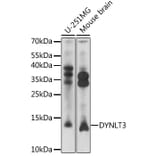 Western Blot - Anti-DYNLT3 Antibody (A92586) - Antibodies.com