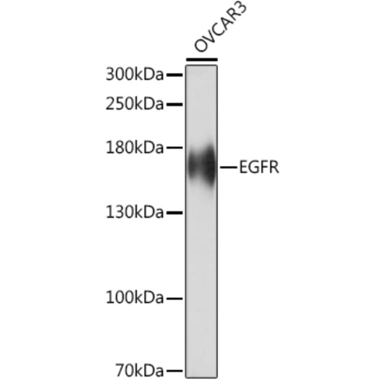 Western Blot - Anti-EGFR Antibody (A92587) - Antibodies.com